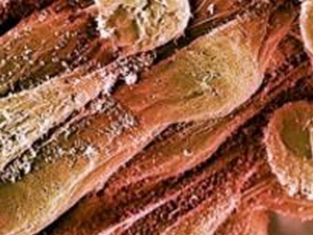Artik `Insan Kalbi´ de üretiliyor.