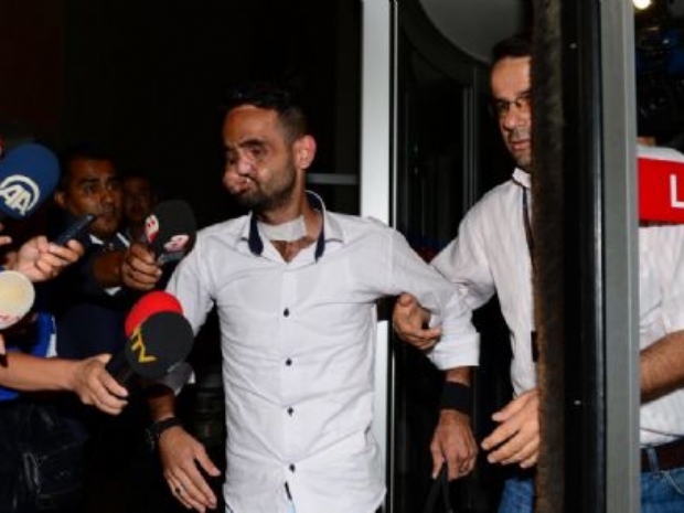 Ağabeyi yüzünü beğendi