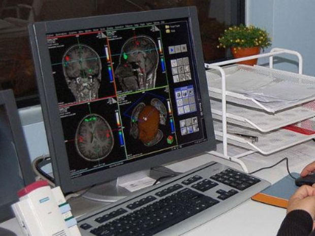 Alzheimer tedavisinde yeni umut